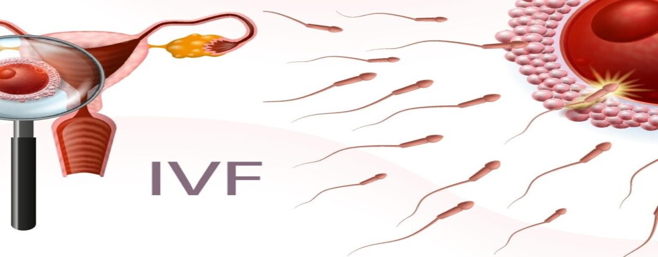 IVF Treatment